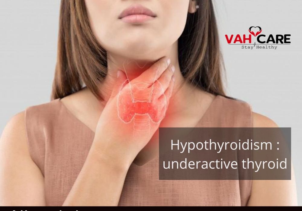 Hypothyroidism : underactive thyroid; cause, symptoms, treatment
